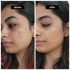 This image has an empty alt attribute; its file name is image.jpeg